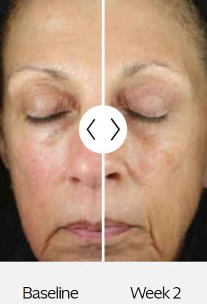 Зволожуючий крем для обличчя ZEIN OBAGI ZO SKIN HEALTH RENEWAL CREME Зволожуючий крем для обличчя ZEIN OBAGI ZO SKIN HEALTH RENEWAL CREME