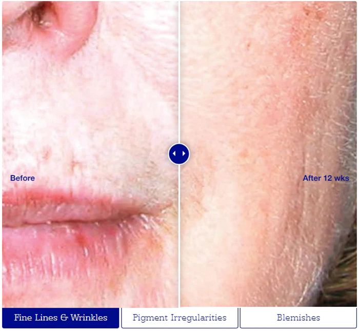 Подарочный набор для сияния, очищения и обновления кожи лица IS CLINICAL RADIANCE COLLECTION HOLIDAY KIT Подарочный набор для сияния, очищения и обновления кожи лица IS CLINICAL RADIANCE COLLECTION HOLIDAY KIT