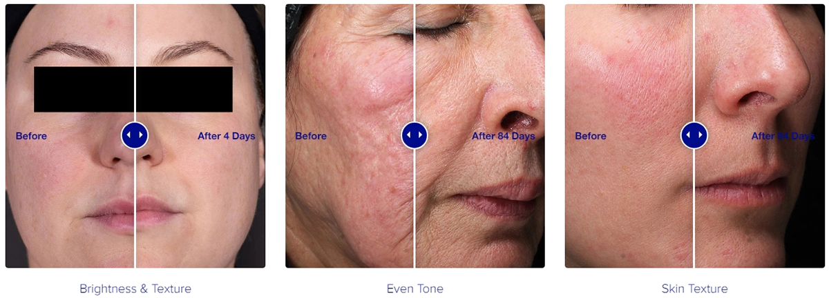 Антивікова емульсія з ретинолом IS CLINICAL RETINOL+ EMULSION 0,1% Антивікова емульсія з ретинолом IS CLINICAL RETINOL+ EMULSION 0,1%