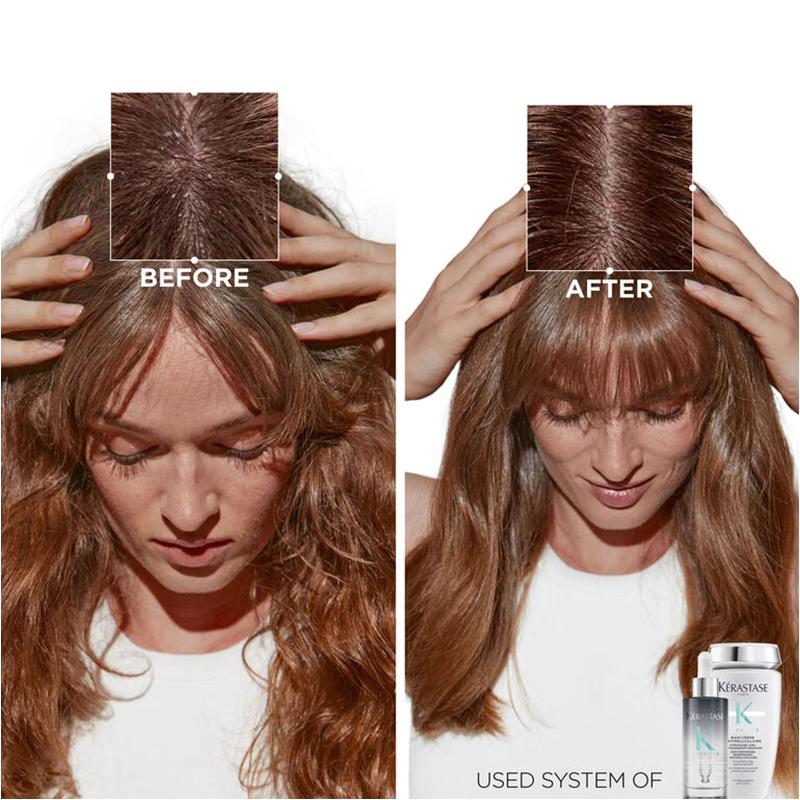 Нічна сироватка проти лупи KERASTASE SYMBIOSE SÉRUM CELLULAIRE NUIT Нічна сироватка проти лупи KERASTASE SYMBIOSE SÉRUM CELLULAIRE NUIT