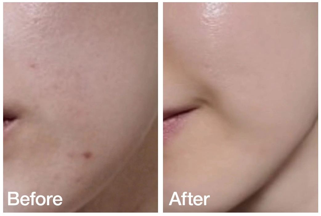 Ампула с 80% хертлифа для увлажнения и успокоения кожи лица ANUA HEARTLEAF 80% MOISTURE SOOTHING AMPOULE Ампула с 80% хертлифа для увлажнения и успокоения кожи лица ANUA HEARTLEAF 80% MOISTURE SOOTHING AMPOULE