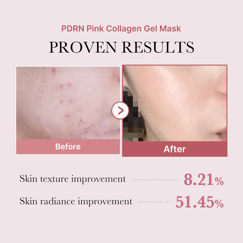 Гидрогелевая маска для лица с PDRN и коллагеном MEDICUBE PDRN PINK COLLAGEN GEL MASK Гидрогелевая маска для лица с PDRN и коллагеном MEDICUBE PDRN PINK COLLAGEN GEL MASK