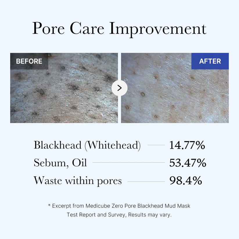Маска для удаления чёрных точек и очищения пор лица MEDICUBE ZERO PORE BLACKHEAD MUD MASK Маска для удаления чёрных точек и очищения пор лица MEDICUBE ZERO PORE BLACKHEAD MUD MASK