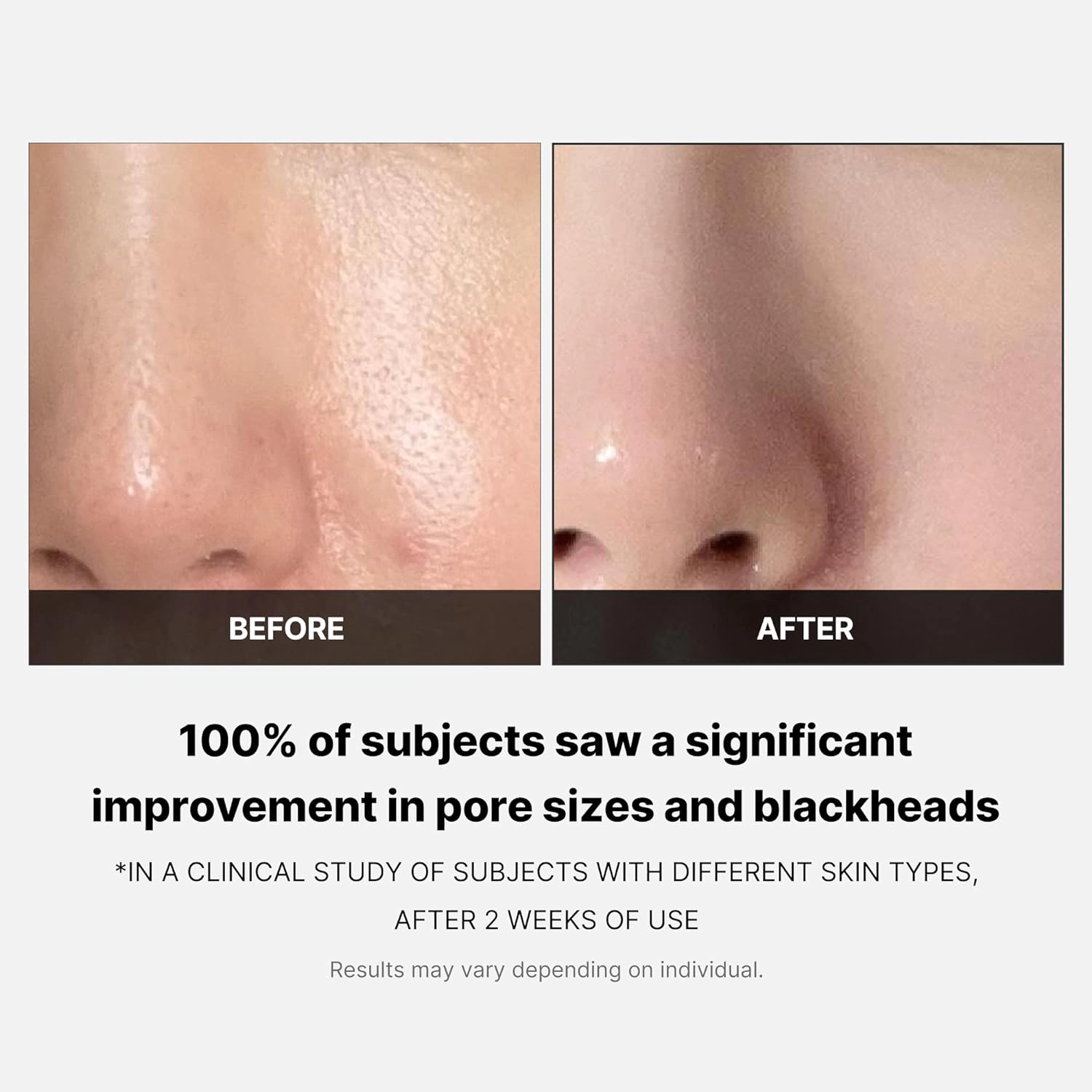 Пилинг-пады для очищения и сужения пор с AHA+BHA кислотами MEDICUBE ZERO PORE PAD 2.0 Пилинг-пады для очищения и сужения пор с AHA+BHA кислотами MEDICUBE ZERO PORE PAD 2.0