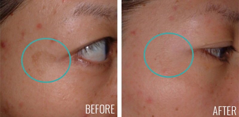 Антивікова освітлювальна сироватка з вітаміном С INSTYTUTUM ANTI-WRINKLE BRIGHTENING C-ERUM WITH VITAMIN C Антивікова освітлювальна сироватка з вітаміном С INSTYTUTUM ANTI-WRINKLE BRIGHTENING C-ERUM WITH VITAMIN C